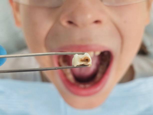 Best Urgent Tooth Repair  in Highland, IN
