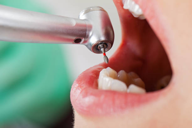 Best Broken Tooth Emergency  in Highland, IN